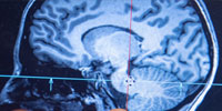 Mathematical Applications in Brain Science